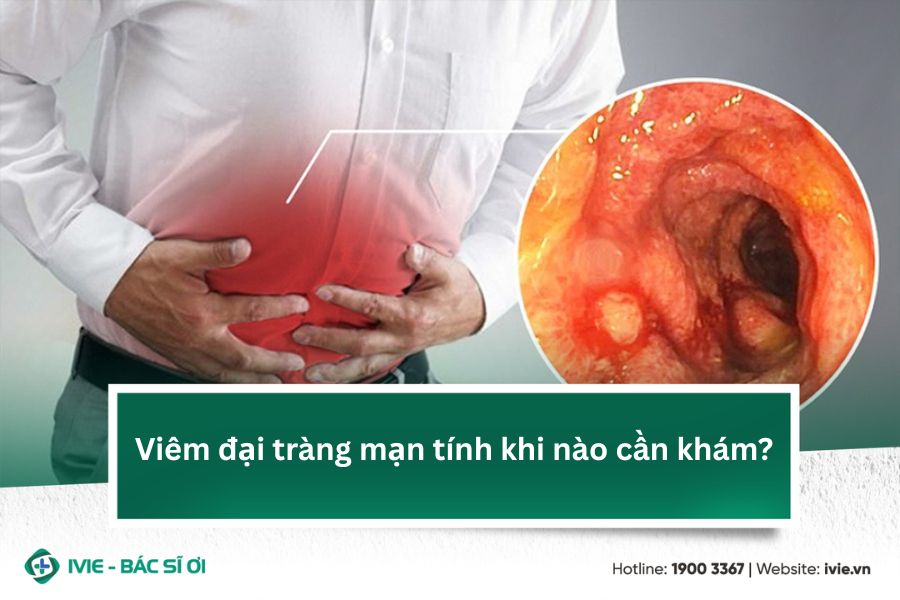 Viêm đại tràng mạn tính khi nào cần khám?