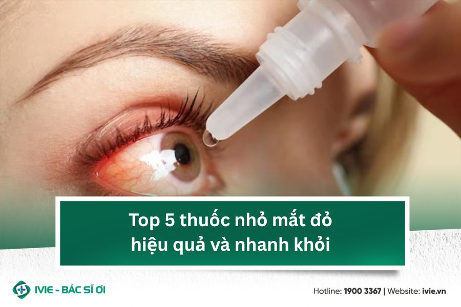 Top 5 thuốc nhỏ mắt đỏ hiệu quả và nhanh khỏi