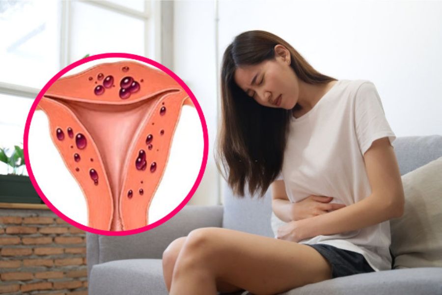 Ra máu giữa kỳ kinh có thể do thay đổi nội tiết, biện pháp tránh thai hoặc bệnh lý phụ khoa