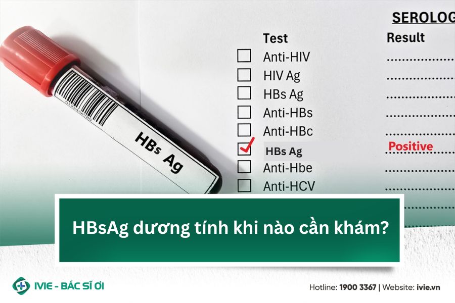 HBsAg dương tính khi nào cần khám?