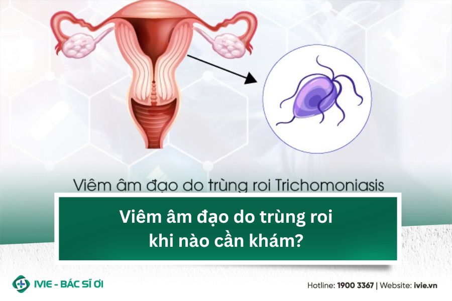 Viêm âm đạo do trùng roi khi nào cần khám?