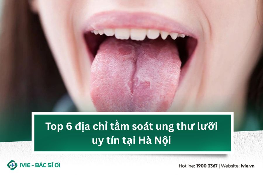 Top 6 địa chỉ tầm soát ung thư lưỡi uy tín tại Hà Nội