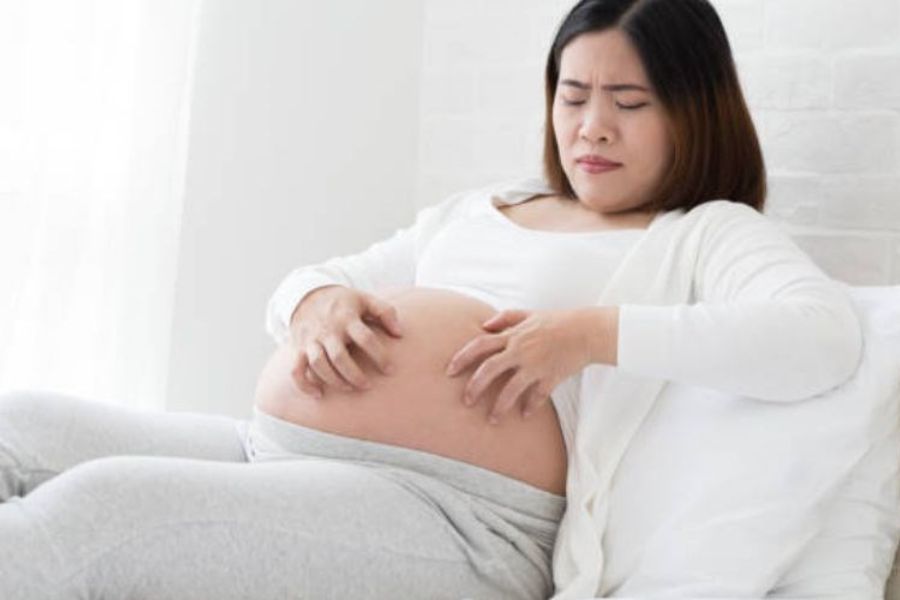 Ứ mật thai kỳ có thể gây ngứa dữ dội, khó cải thiện chỉ bằng kem dưỡng ẩm