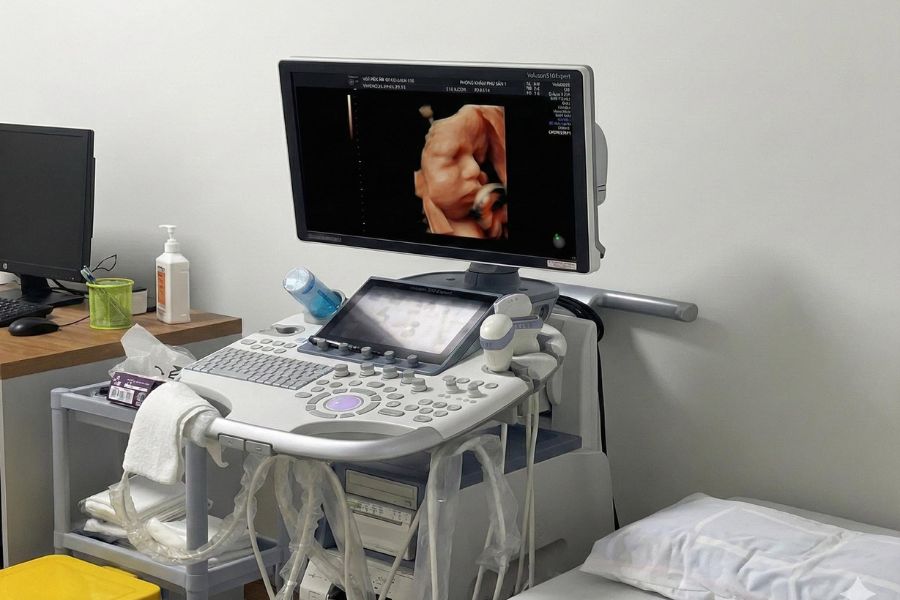 Siêu âm 4D là kỹ thuật quan trọng trong gói theo dõi thai sản giúp khảo sát chi tiết hình thái thai nhi