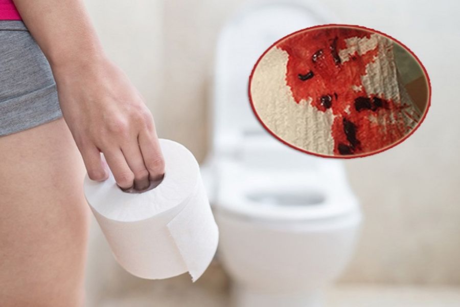 Đi ngoài ra máu, thay đổi thói quen đại tiện kéo dài và sụt cân bất thường có thể là dấu hiệu cảnh báo ung thư đại trực tràng