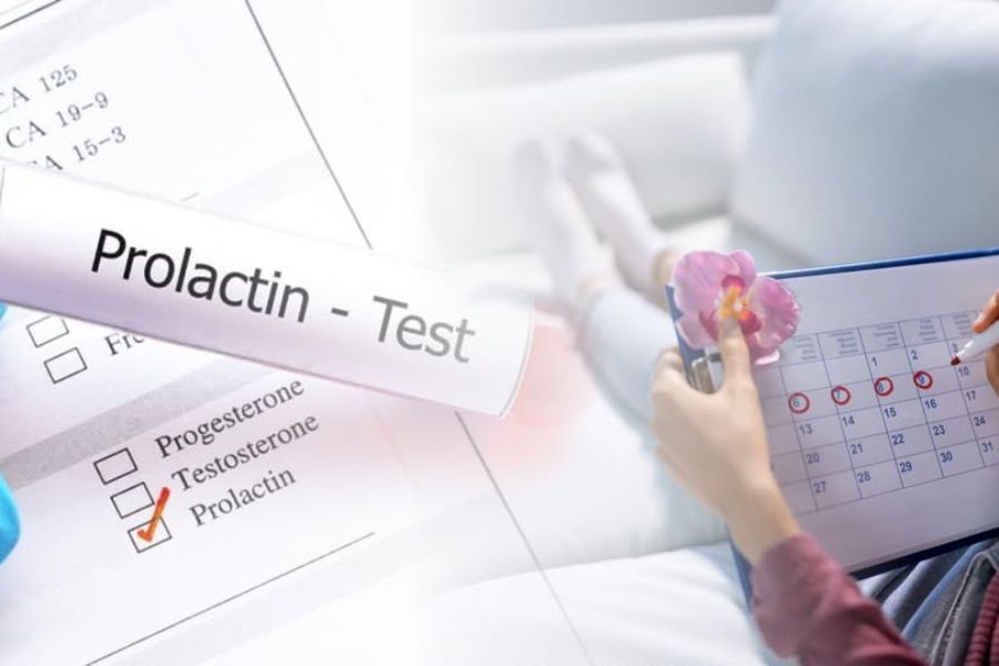 Prolactin cao có thể gây kinh nguyệt không đều, tiết sữa ngoài thai kỳ và khó thụ thai