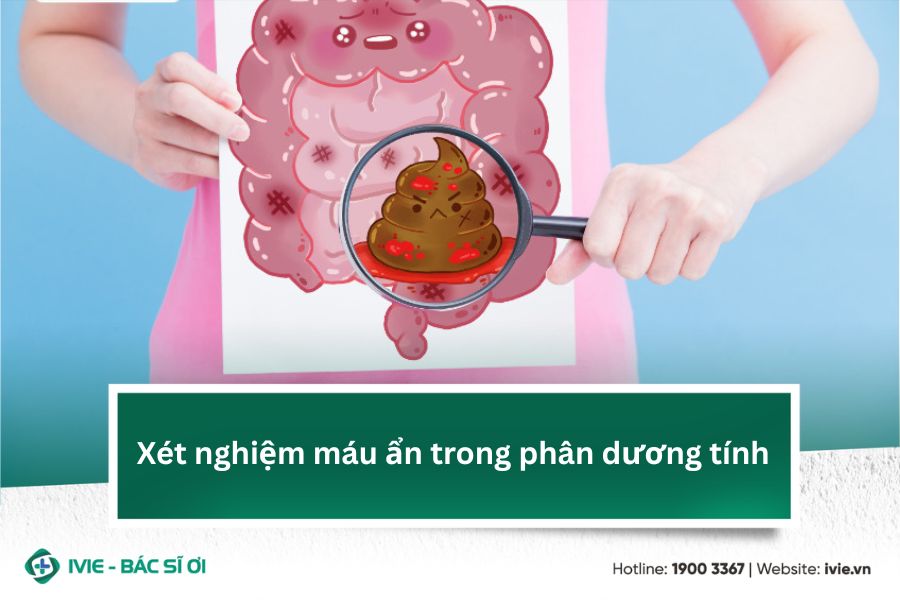 Xét nghiệm máu ẩn trong phân dương tính