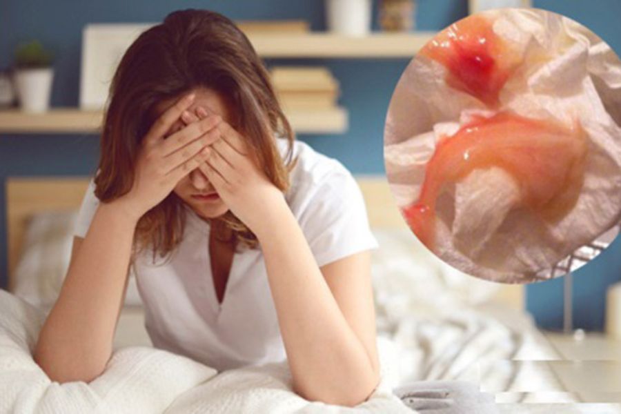 Hiểu rõ các nguyên nhân sinh lý và bệnh lý phụ khoa dẫn đến tình trạng ra dịch nâu giữa chu kỳ