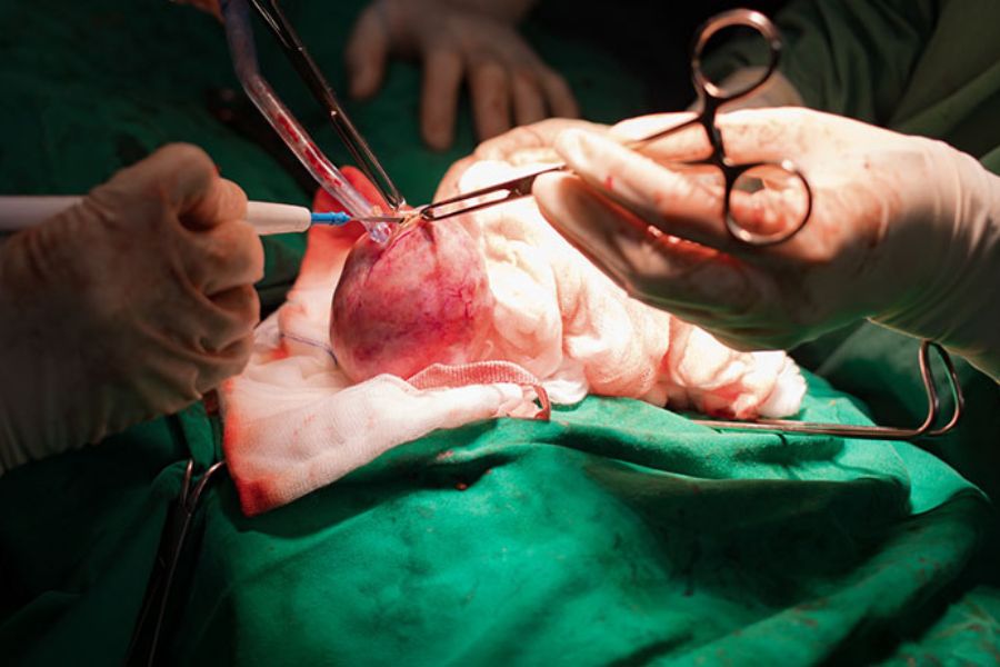 Định kỳ theo dõi sức khỏe và siêu âm giúp bác sĩ đưa ra phác đồ điều trị u xơ tử cung phù hợp nhất