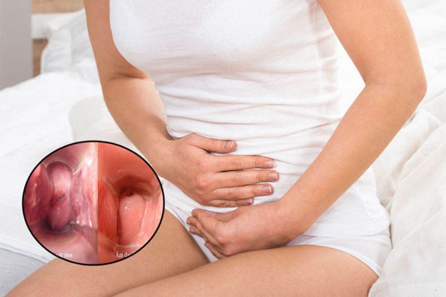 Mẹ bầu nên chú ý quan sát các thay đổi bất thường ở vùng kín để thăm khám kịp thời