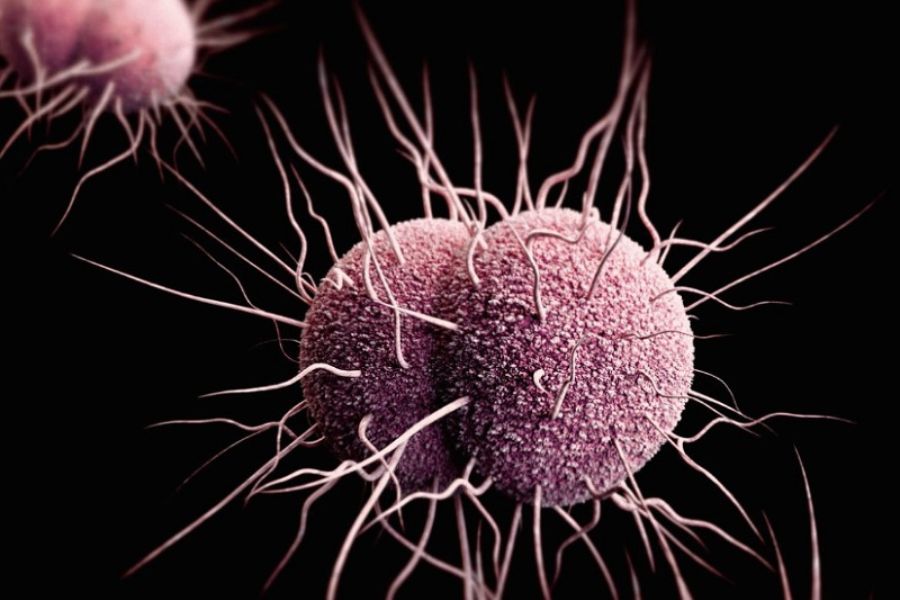 Vi khuẩn Neisseria gonorrhoeae là tác nhân chính gây ra bệnh lậu ở cả nam và nữ
