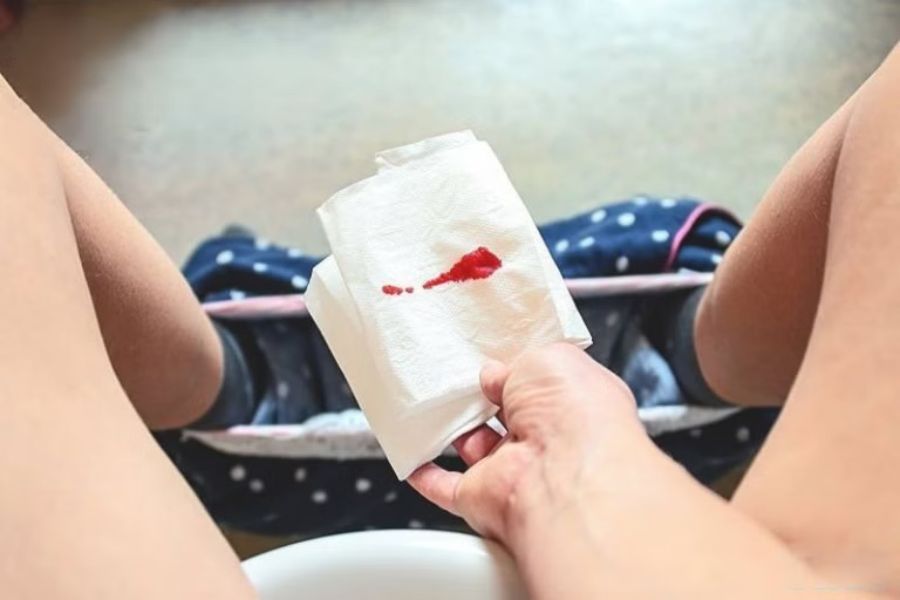 Dấu hiệu và triệu chứng nhận biết hiện tượng nhau tiền đạo ở phụ nữ mang thai