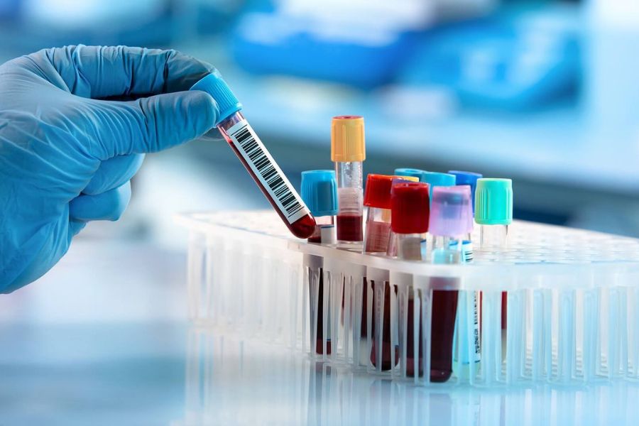 Người bệnh cần thực hiện các xét nghiệm chuyên sâu và tham khảo ý kiến bác sĩ chuyên khoa trước khi quyết định điều trị