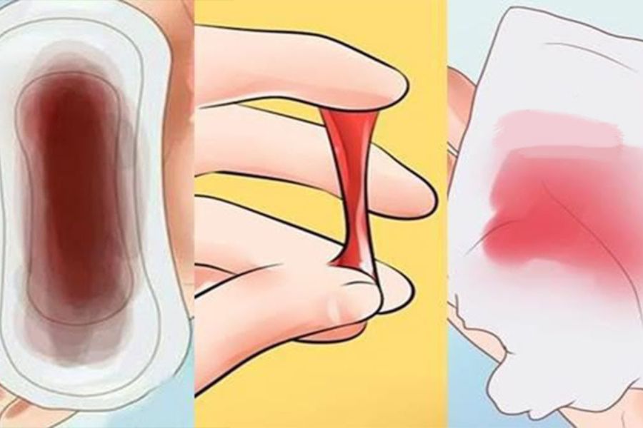 Khí hư bất thường, đau khi quan hệ và chảy máu ngoài kỳ kinh có thể là dấu hiệu nhiễm Chlamydia