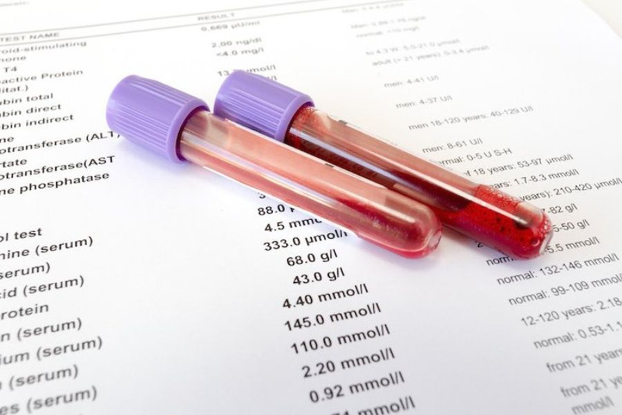HBeAg là kháng nguyên của virus viêm gan B, còn Anti-HBe là kháng thể do cơ thể tạo ra để đáp ứng với kháng nguyên này
