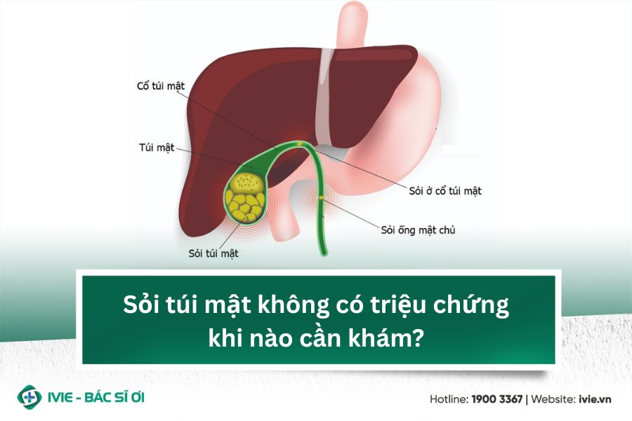 Sỏi túi mật không có triệu chứng khi nào cần khám?