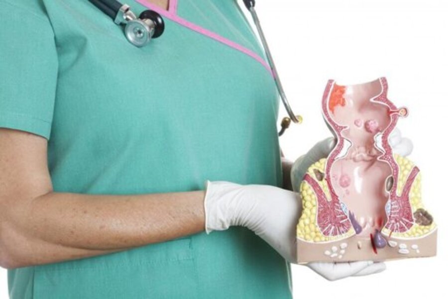 Thăm khám điều trị bệnh trĩ tại Hà Nội ở Medlatec. 