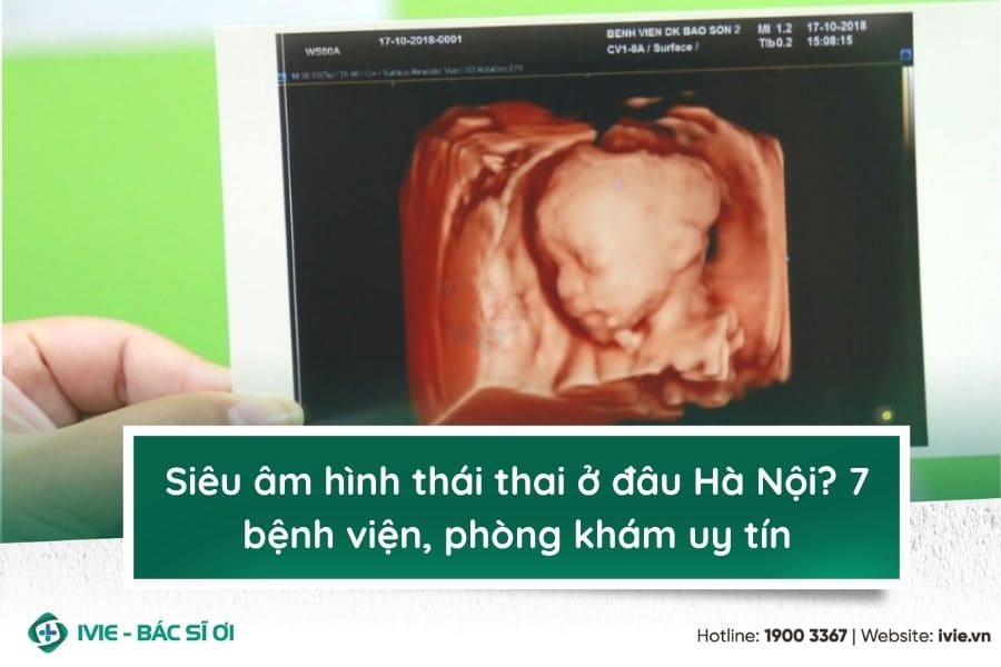 Siêu âm hình thái thai ở đâu Hà Nội? 7 bệnh viện, phòng...