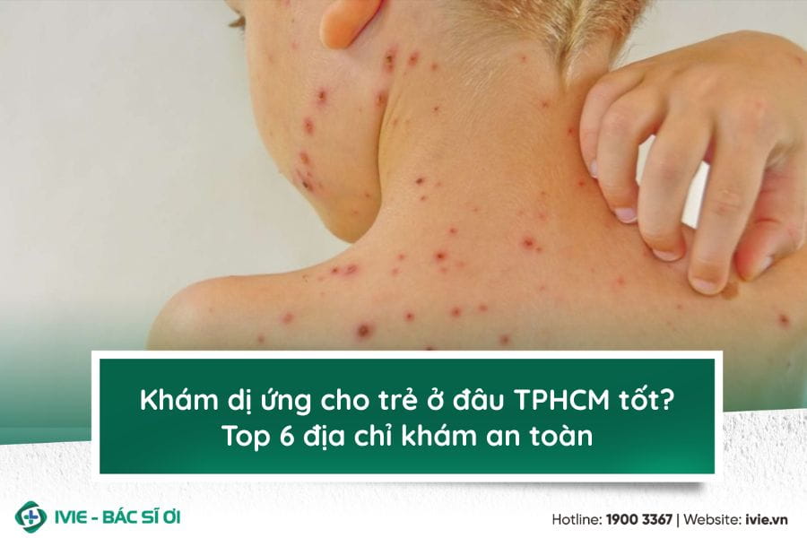 Khám dị ứng cho trẻ ở đâu TPHCM tốt? Top 6 địa chỉ khám an...
