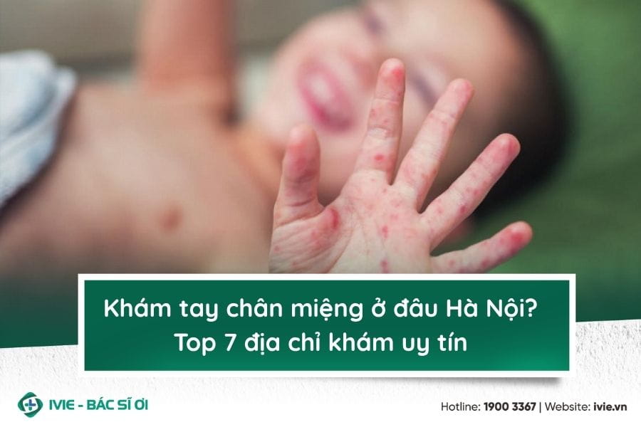 Khám tay chân miệng ở đâu Hà Nội? Top 7 địa chỉ khám uy tín