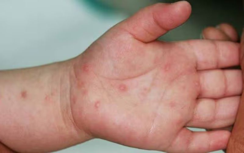 Chuyên khoa Nhi Bệnh viện Hoàn Mỹ Sài Gòn là nơi bố mẹ có thể tìm hiểu khi cần khám tay chân miệng ở đâu TPHCM (Ảnh: Bệnh viện Hoàn Mỹ Sài Gòn)