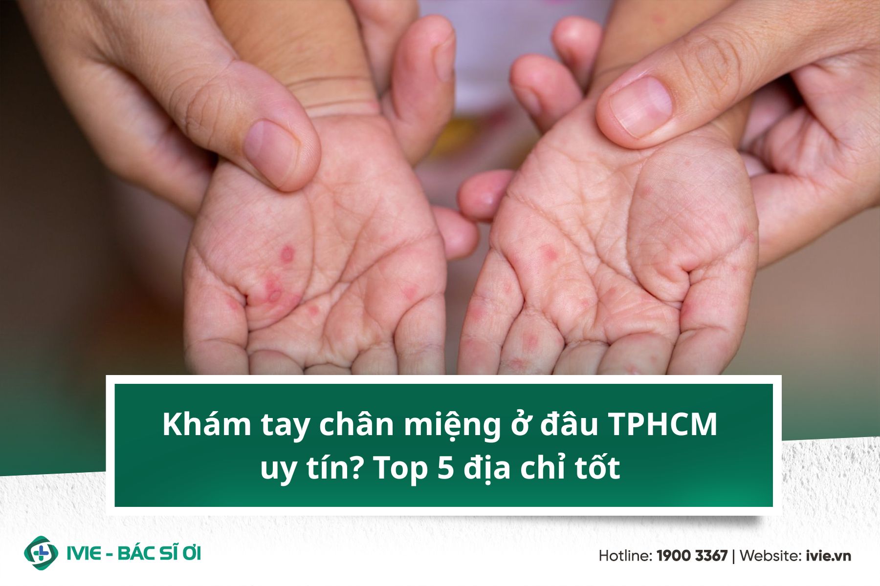 Khám tay chân miệng ở đâu TPHCM uy tín? Top 5 địa chỉ tốt