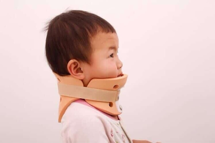Trẻ bị vẹo cổ bẩm sinh cần thăm khám sớm nhất để có hướng điều trị, tránh để lại dị tật. 