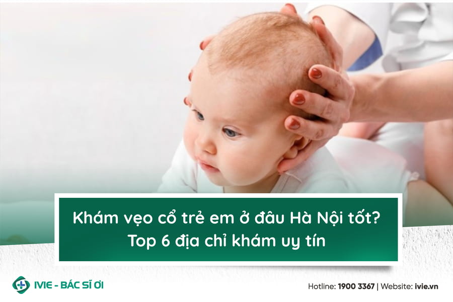 Khám vẹo cổ trẻ em ở đâu Hà Nội tốt? Top 6 địa chỉ khám uy...